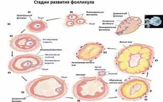 Последствия появления персистирующего фолликула у женщин