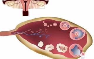 Для чего проводится УЗИ яичников у женщины
