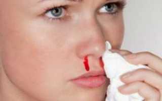 Кровь из носа при высмаркивании