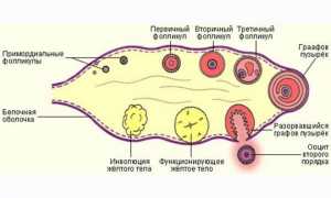 Эффективные способы терапии атрезии фолликула