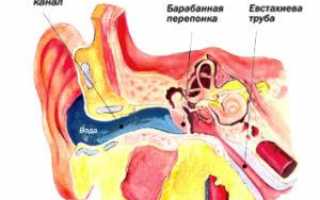 Как убрать воду из уха